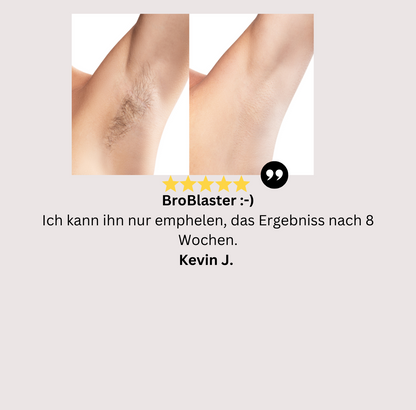 BroBlaster Permanente Haarentfernung für Boys auch Girls