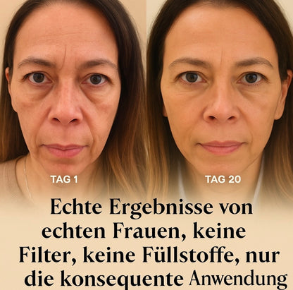 HydroBloom™ Hyaluron Eye Patches