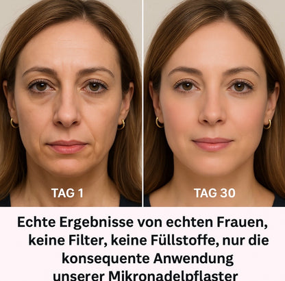 HydroBloom™ Hyaluron Eye Patches